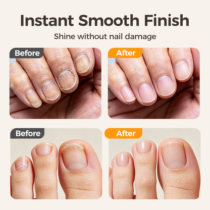 🔥Mega-Angebot – 50 % Rabatt!💅Elektrischer 2-in-1 Smart-Nagelknipser & Polierer🌟